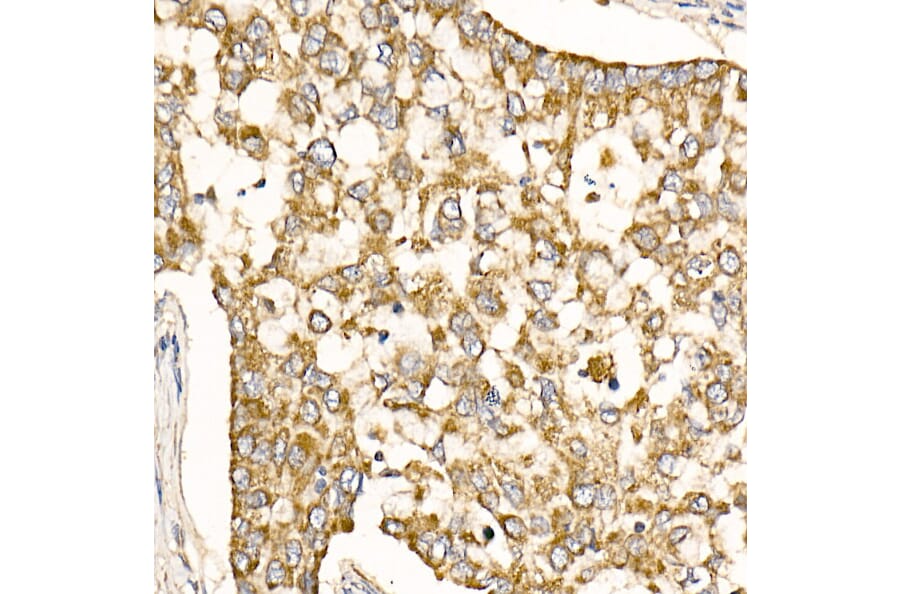 Immunohistochemistry - Anti-Prohibitin Antibody (A89192) - Antibodies.com