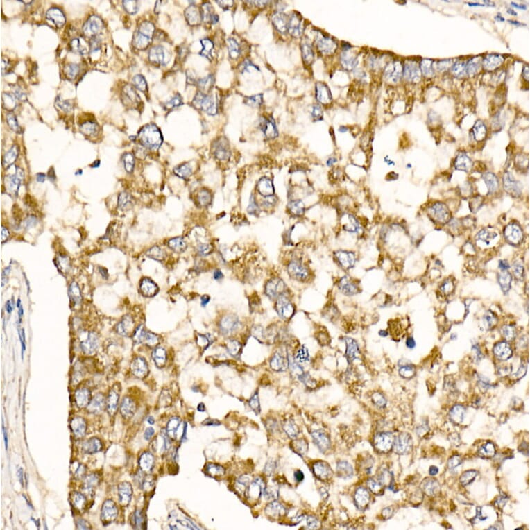 Immunohistochemistry - Anti-Prohibitin Antibody (A89192) - Antibodies.com