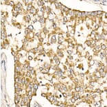 Immunohistochemistry - Anti-Prohibitin Antibody (A89192) - Antibodies.com
