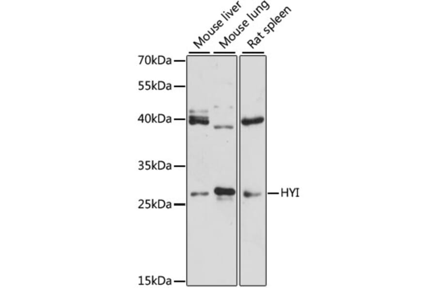 Western Blot - Anti-HYI Antibody (A12806) - Antibodies.com