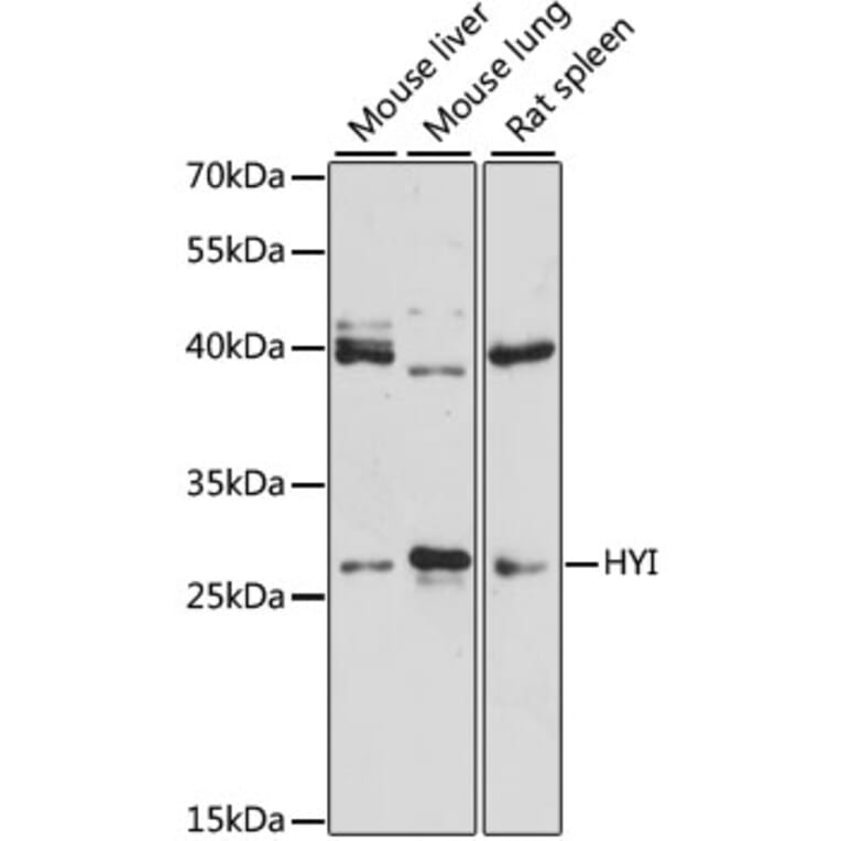 Western Blot - Anti-HYI Antibody (A12806) - Antibodies.com