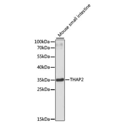 Western Blot - Anti-THAP2 Antibody (A89194) - Antibodies.com