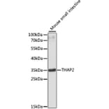 Western Blot - Anti-THAP2 Antibody (A89194) - Antibodies.com