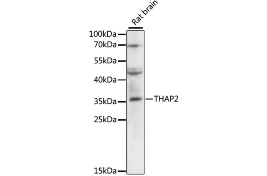 Western Blot - Anti-THAP2 Antibody (A89194) - Antibodies.com