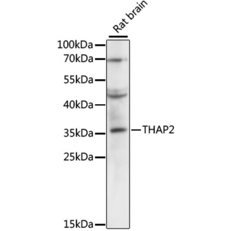 Western Blot - Anti-THAP2 Antibody (A89194) - Antibodies.com