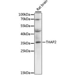 Western Blot - Anti-THAP2 Antibody (A89194) - Antibodies.com