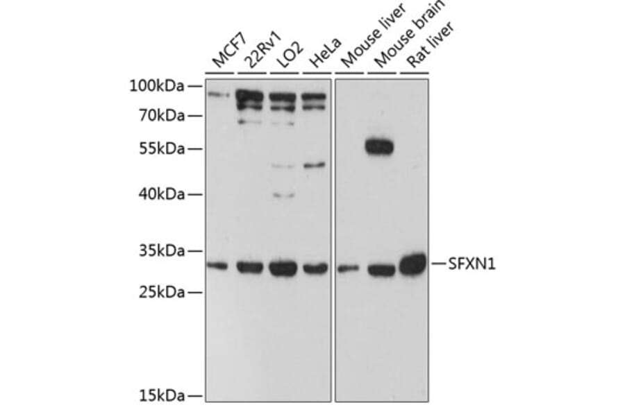 Western Blot - Anti-SFXN1/TCC Antibody (A89195) - Antibodies.com