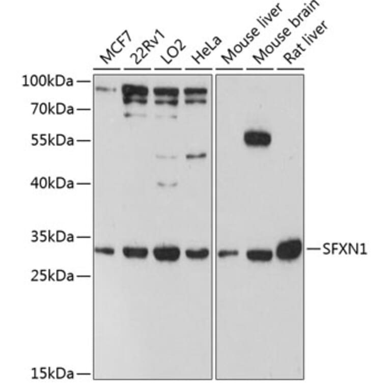 Western Blot - Anti-SFXN1/TCC Antibody (A89195) - Antibodies.com