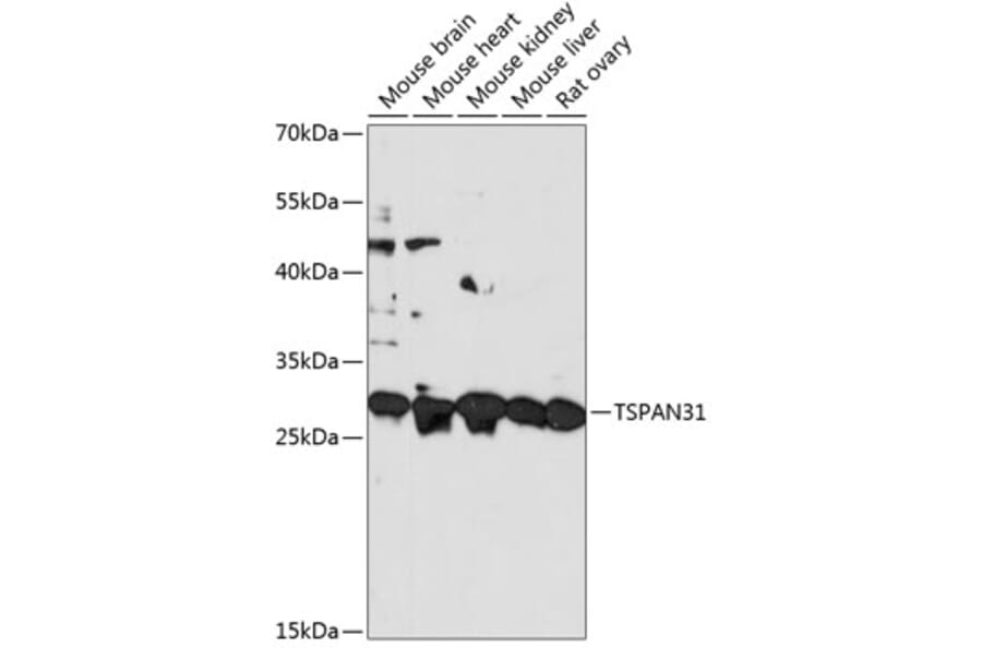 Western Blot - Anti-TSPAN31 Antibody (A89196) - Antibodies.com