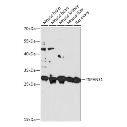 Western Blot - Anti-TSPAN31 Antibody (A89196) - Antibodies.com