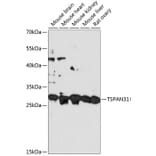 Western Blot - Anti-TSPAN31 Antibody (A89196) - Antibodies.com