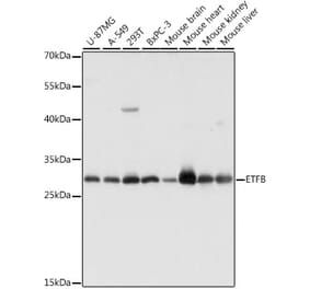 Western Blot - Anti-ETFB Antibody (A89197) - Antibodies.com