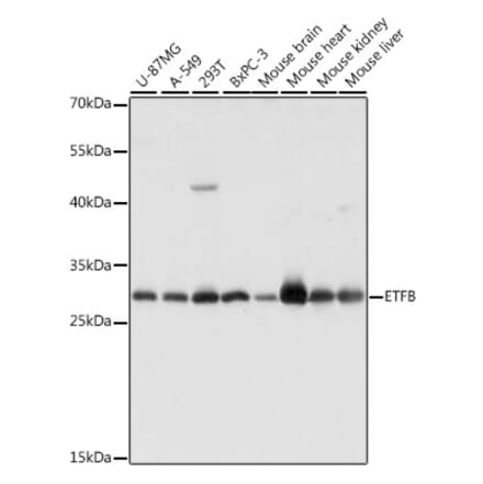 Western Blot - Anti-ETFB Antibody (A89197) - Antibodies.com