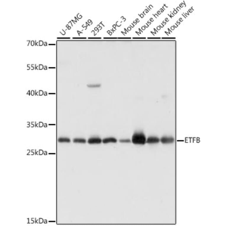 Western Blot - Anti-ETFB Antibody (A89197) - Antibodies.com