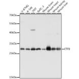 Western Blot - Anti-ETFB Antibody (A89197) - Antibodies.com