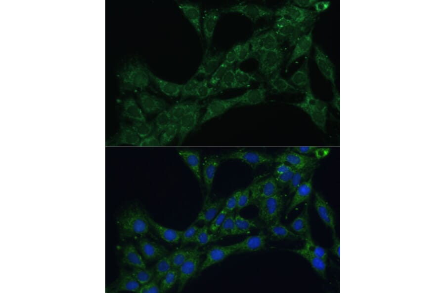 Immunofluorescence - Anti-ETFB Antibody (A89197) - Antibodies.com