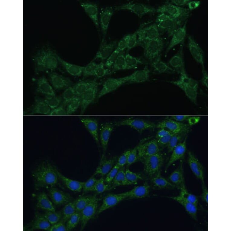 Immunofluorescence - Anti-ETFB Antibody (A89197) - Antibodies.com