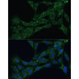 Immunofluorescence - Anti-ETFB Antibody (A89197) - Antibodies.com