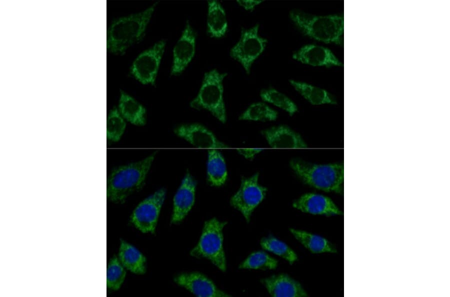 Immunofluorescence - Anti-ETFB Antibody (A89197) - Antibodies.com