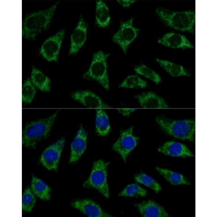 Immunofluorescence - Anti-ETFB Antibody (A89197) - Antibodies.com