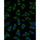 Immunofluorescence - Anti-ETFB Antibody (A89197) - Antibodies.com