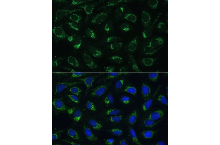 Immunofluorescence - Anti-ETFB Antibody (A89197) - Antibodies.com