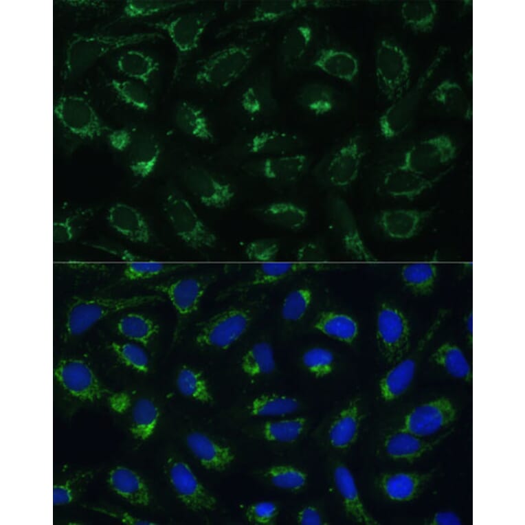 Immunofluorescence - Anti-ETFB Antibody (A89197) - Antibodies.com