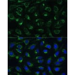 Immunofluorescence - Anti-ETFB Antibody (A89197) - Antibodies.com