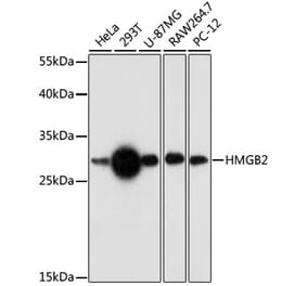 Western Blot - Anti-HMGB2 Antibody (A89198) - Antibodies.com