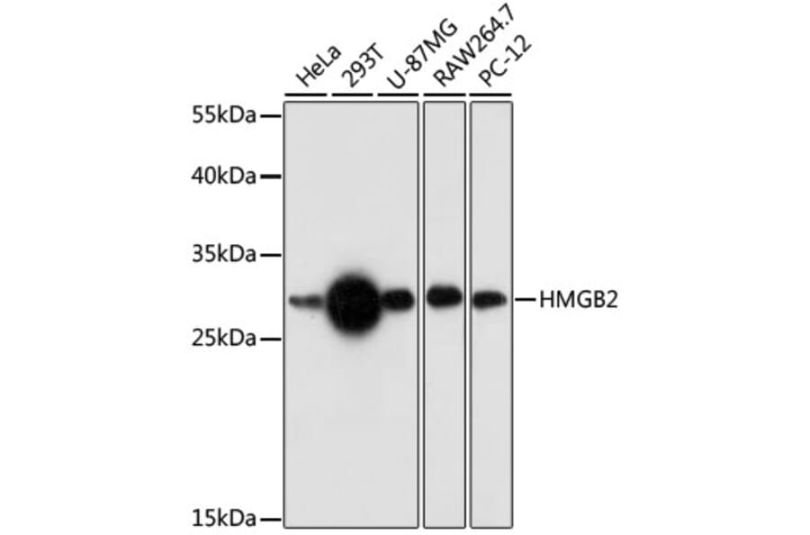Western Blot - Anti-HMGB2 Antibody (A89198) - Antibodies.com