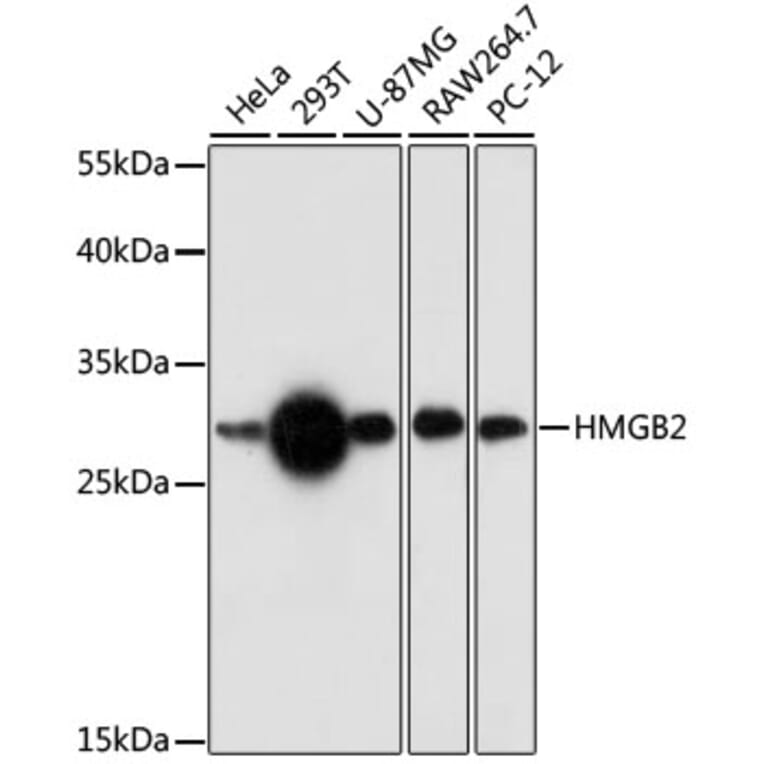 Western Blot - Anti-HMGB2 Antibody (A89198) - Antibodies.com