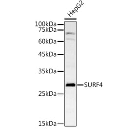 Western Blot - Anti-SURF4 Antibody (A89199) - Antibodies.com