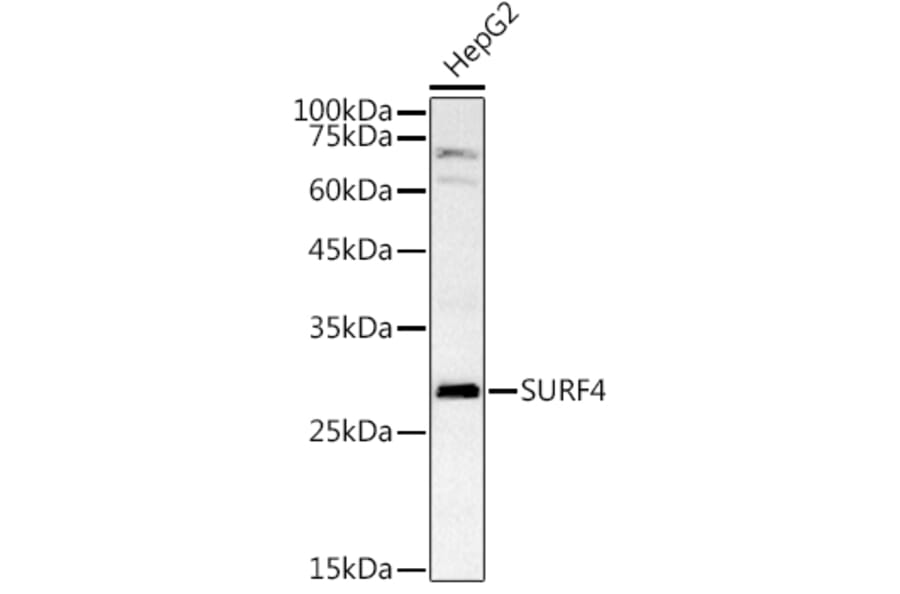 Western Blot - Anti-SURF4 Antibody (A89199) - Antibodies.com