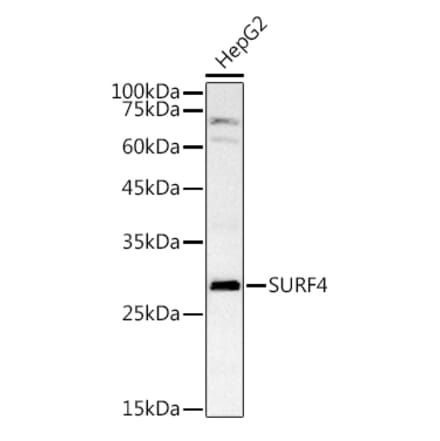 Western Blot - Anti-SURF4 Antibody (A89199) - Antibodies.com