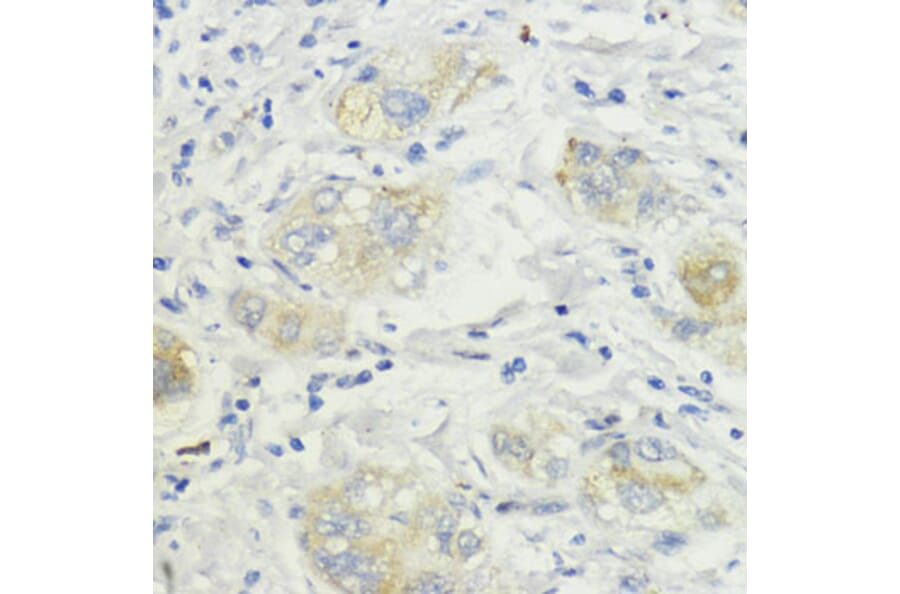 Immunohistochemistry - Anti-SURF4 Antibody (A89199) - Antibodies.com