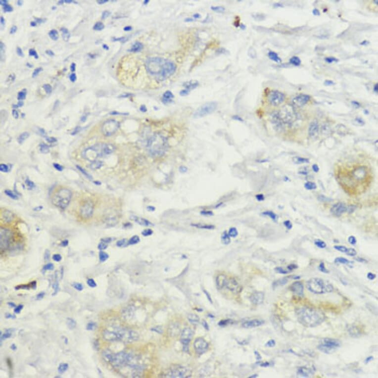 Immunohistochemistry - Anti-SURF4 Antibody (A89199) - Antibodies.com
