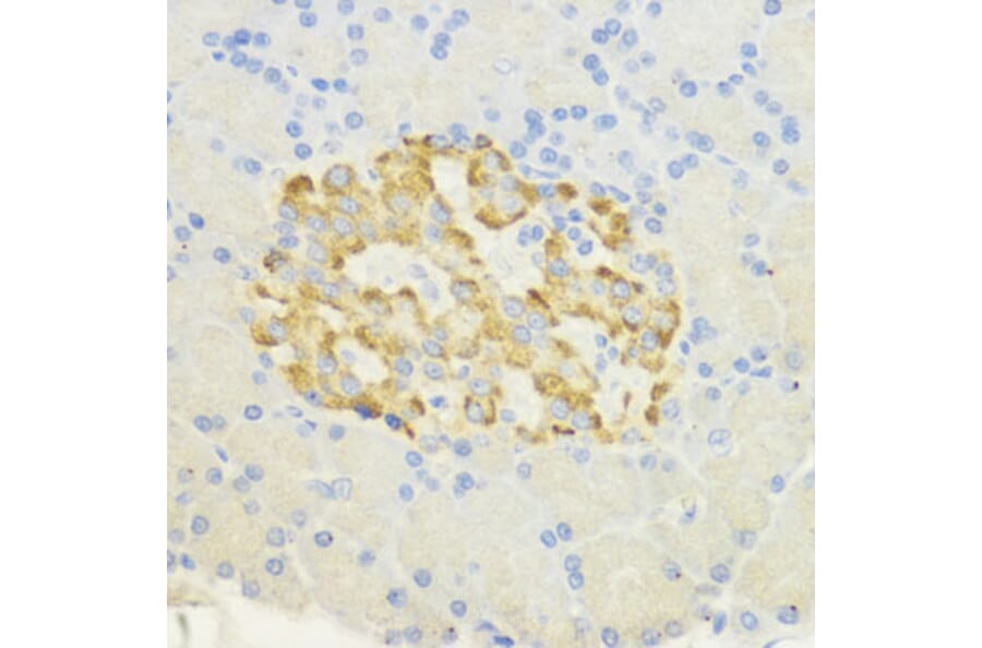 Immunohistochemistry - Anti-SURF4 Antibody (A89199) - Antibodies.com