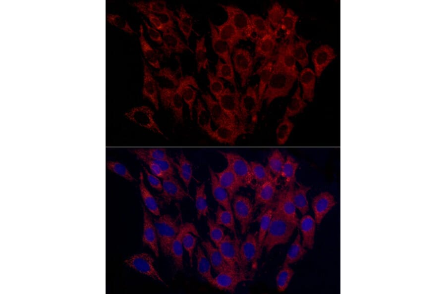 Immunofluorescence - Anti-SURF4 Antibody (A89199) - Antibodies.com