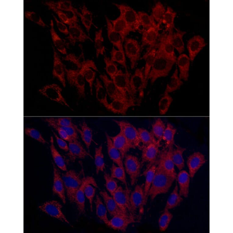 Immunofluorescence - Anti-SURF4 Antibody (A89199) - Antibodies.com