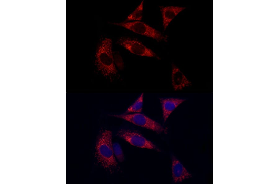 Immunofluorescence - Anti-SURF4 Antibody (A89199) - Antibodies.com
