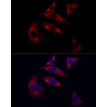 Immunofluorescence - Anti-SURF4 Antibody (A89199) - Antibodies.com