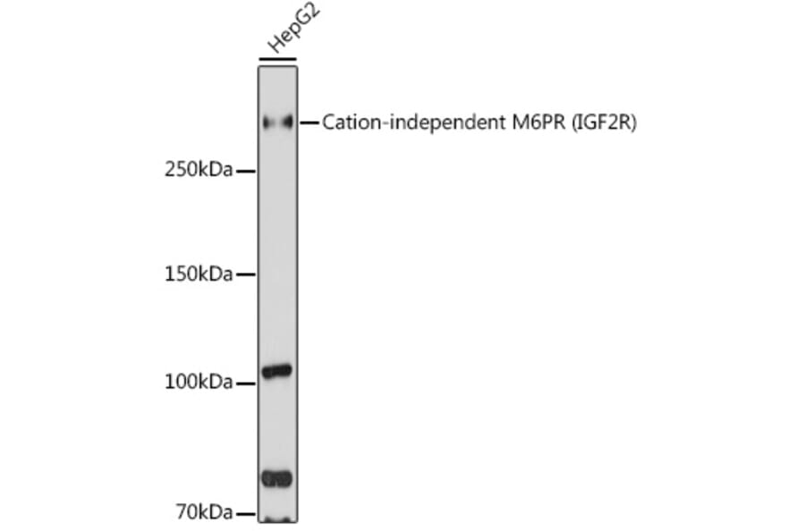 Western Blot - Anti-M6PR (cation independent) Antibody (A89200) - Antibodies.com