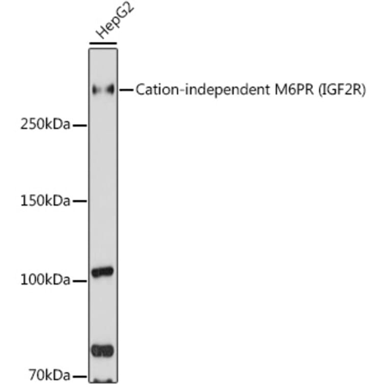 Western Blot - Anti-M6PR (cation independent) Antibody (A89200) - Antibodies.com