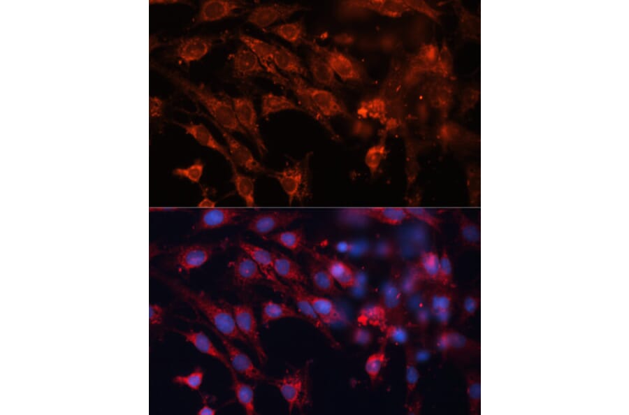 Immunofluorescence - Anti-M6PR (cation independent) Antibody (A89200) - Antibodies.com