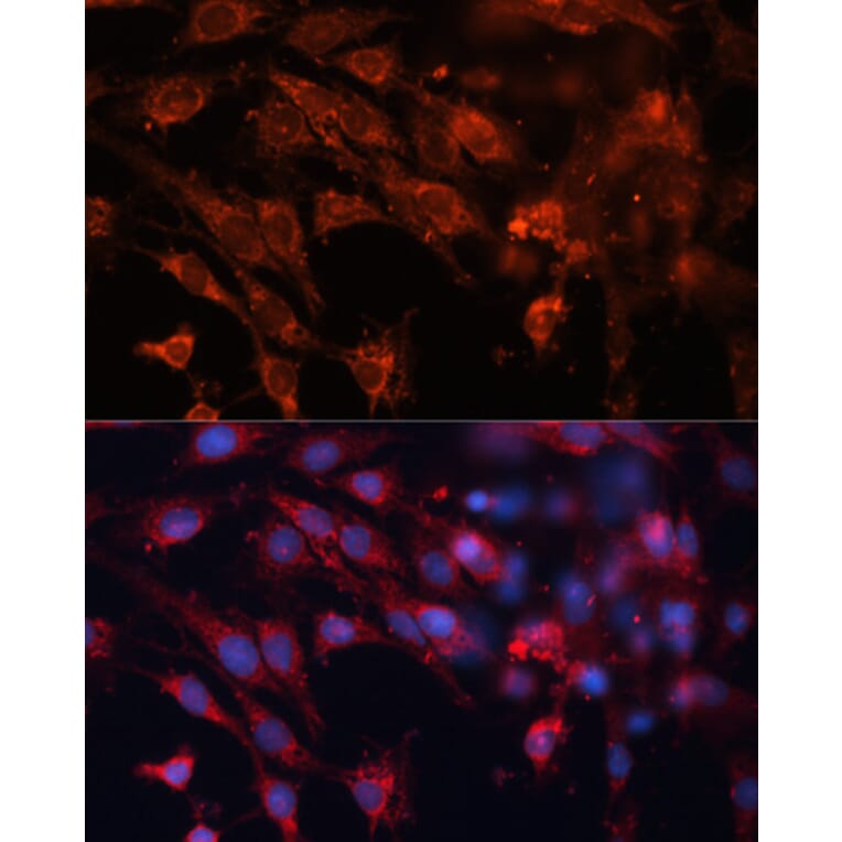 Immunofluorescence - Anti-M6PR (cation independent) Antibody (A89200) - Antibodies.com