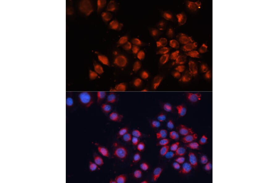 Immunofluorescence - Anti-M6PR (cation independent) Antibody (A89200) - Antibodies.com