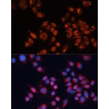 Immunofluorescence - Anti-M6PR (cation independent) Antibody (A89200) - Antibodies.com