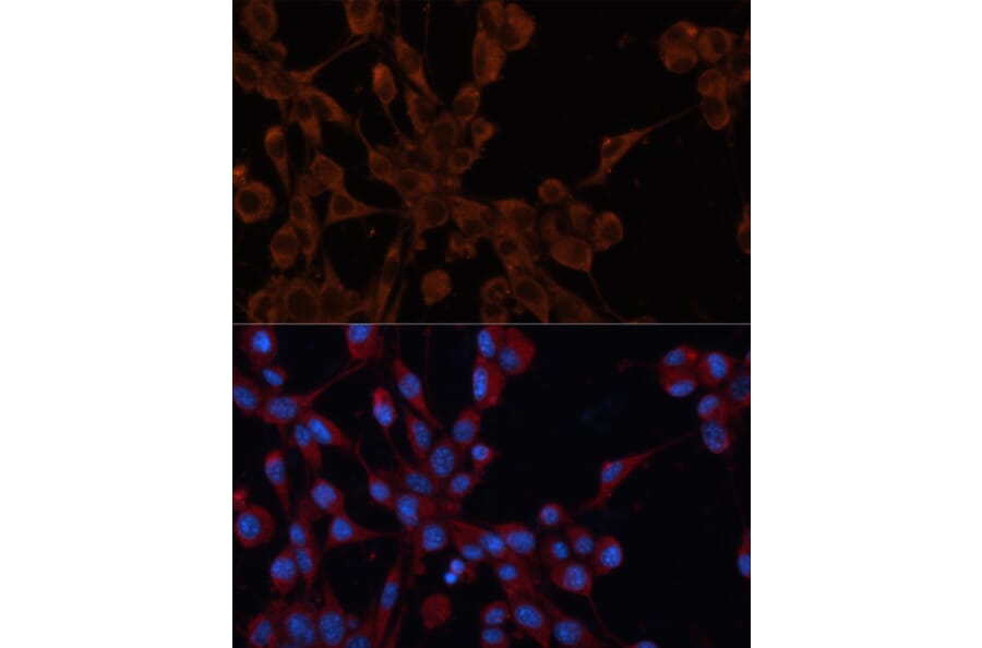 Immunofluorescence - Anti-M6PR (cation independent) Antibody (A89200) - Antibodies.com
