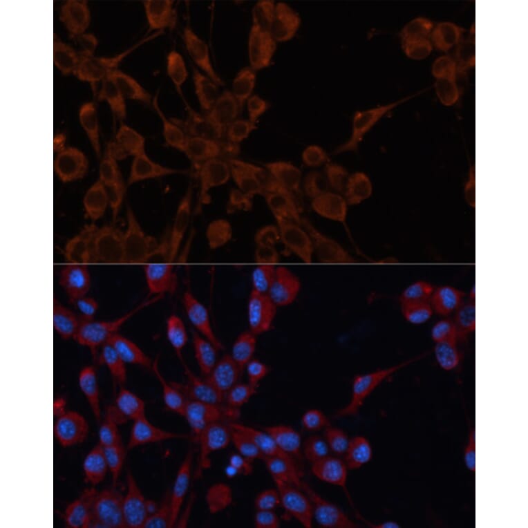 Immunofluorescence - Anti-M6PR (cation independent) Antibody (A89200) - Antibodies.com