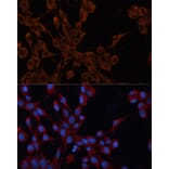 Immunofluorescence - Anti-M6PR (cation independent) Antibody (A89200) - Antibodies.com